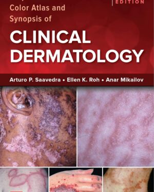 Fitzpatrick's Color Atlas and Synopsis of Clinical Dermatology, Ninth Edition 9th Edition