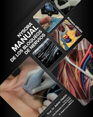 NYSORA Manual de los Bloqueos de Nervios Primera Edición