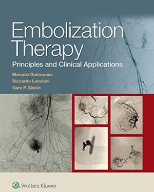 Embolization Therapy: Principles and Clinical Applications First Edition, Kindle Edition