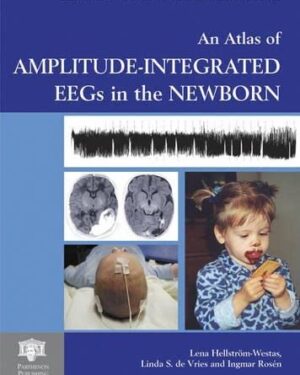 An Atlas of Amplitude-Integrated EEGs in the Newborn, Second Edition