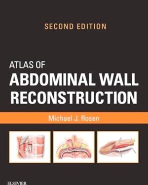Atlas of Abdominal Wall Reconstruction Expert Consult 2nd Edition