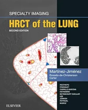 Specialty Imaging HRCT of the Lung E-Book 2nd Edition