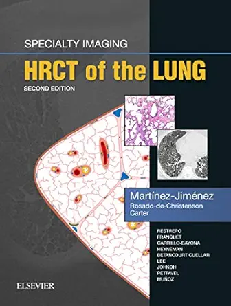 Specialty Imaging HRCT of the Lung E-Book 2nd Edition