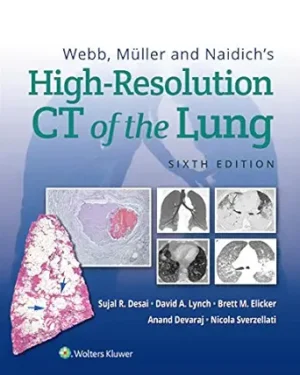 Webb, Müller and Naidich's High-Resolution CT of the Lung 6th Edition