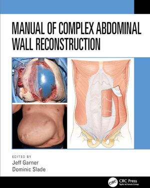 Manual of Complex Abdominal Wall Reconstruction 1st Edition