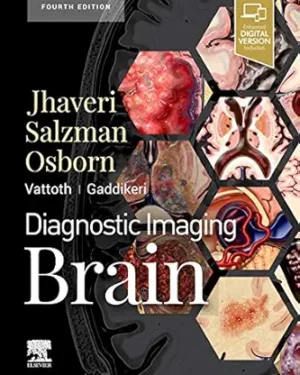 Diagnostic Imaging Brain E-Book 4th Edition